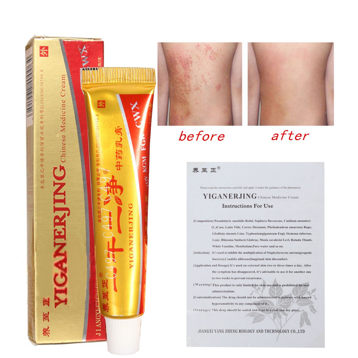 chinese-medicine-for-eczema-natural-remedies-for-eczema