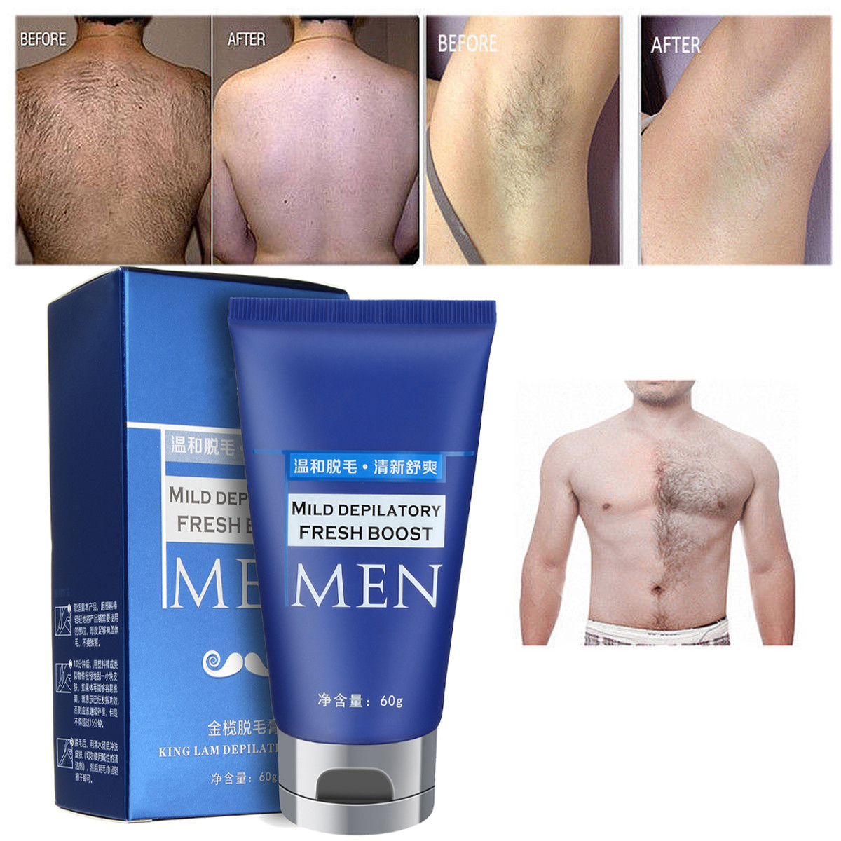 permanent body hair removal