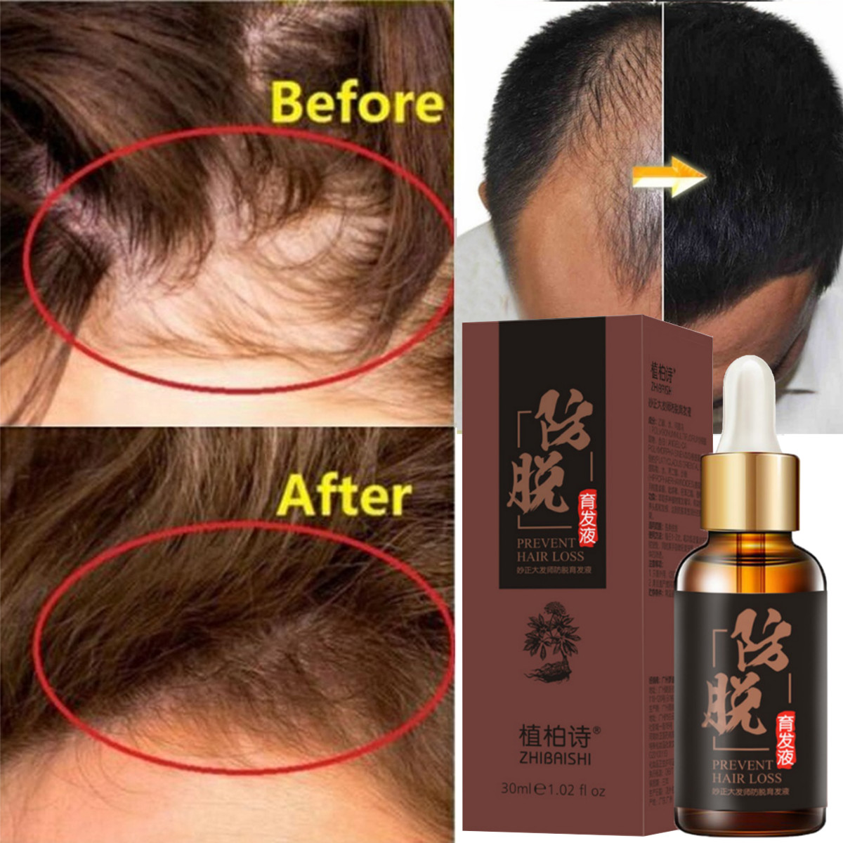 30ml Anti Hair Loss Essences Natural Fast Hair Growth Regrowth